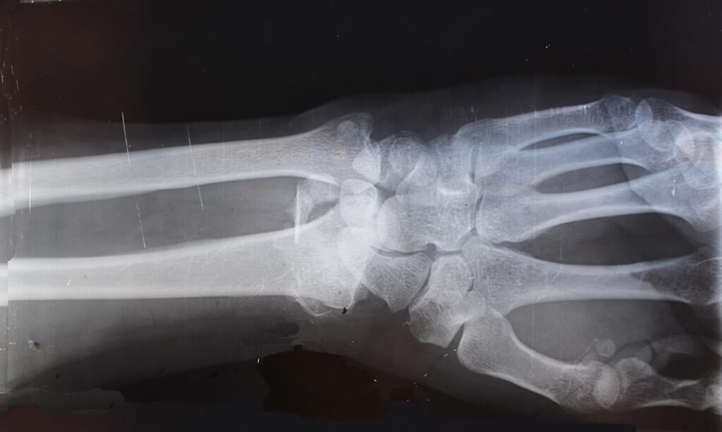 Pennsylvania work injury