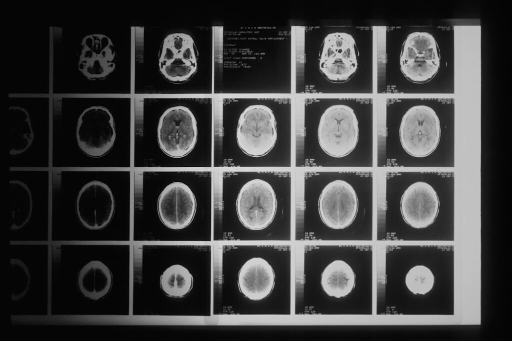 Brain injury lawyer