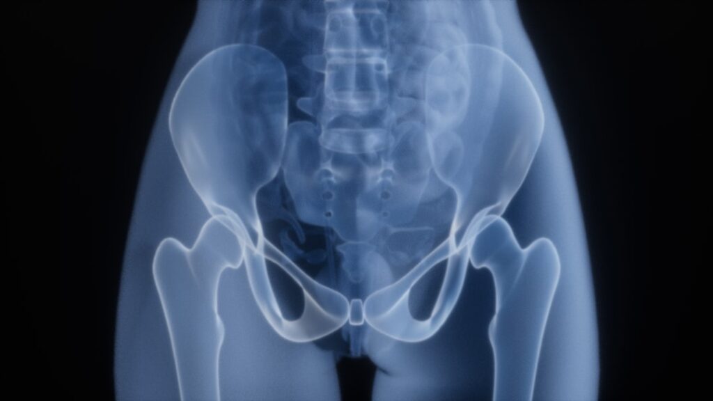 Feasterville hip fracture attorney
