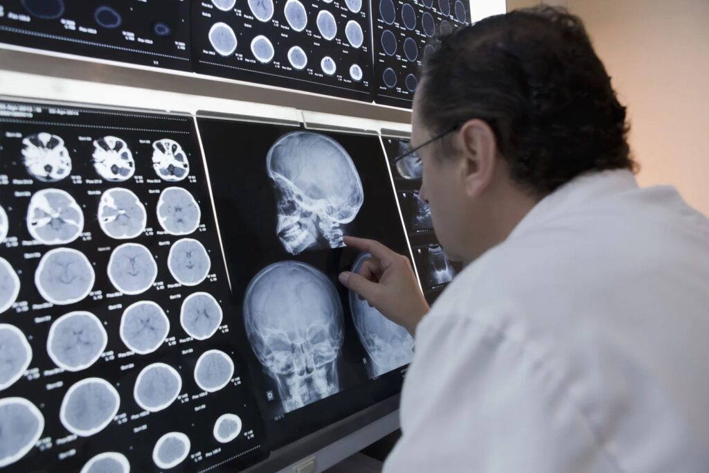 Brain injury attorney Philadelphia