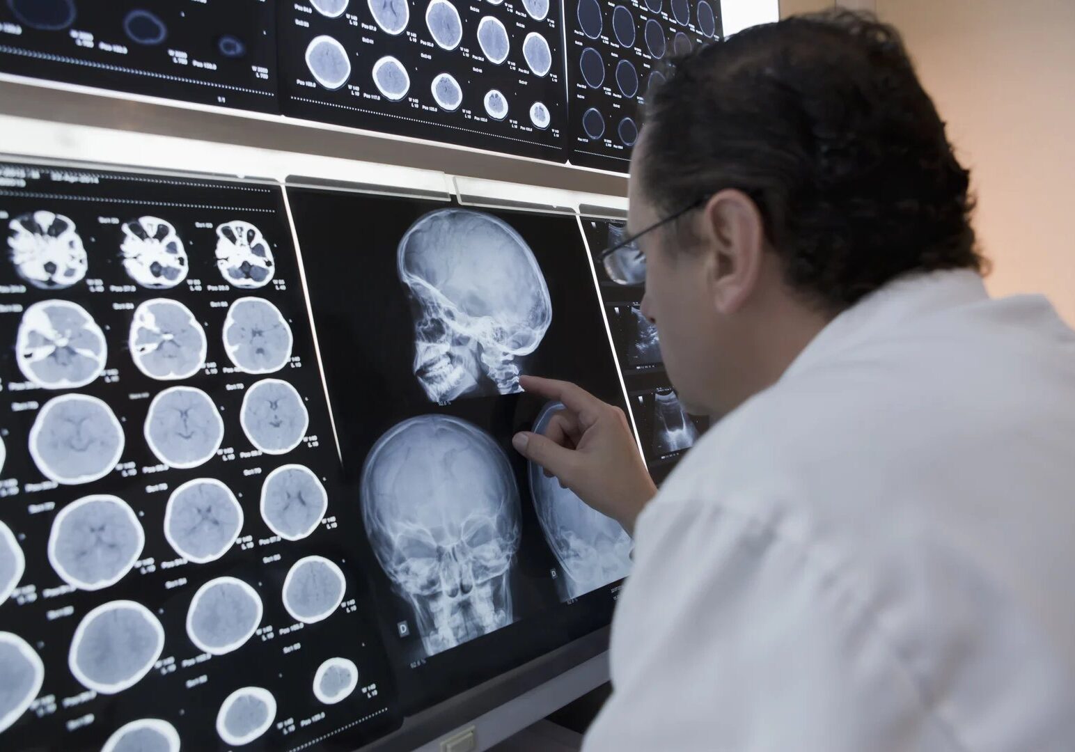 Brain injury attorney Philadelphia