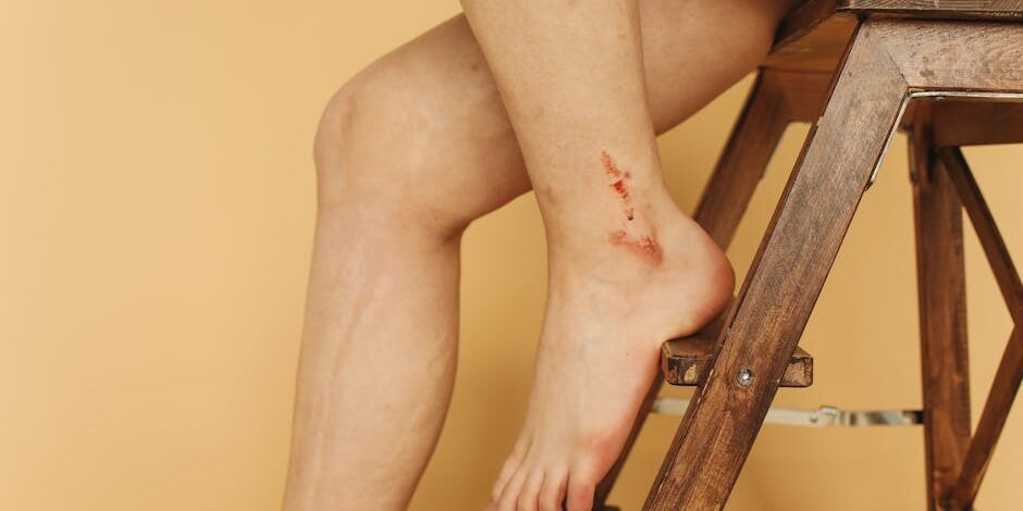 brain-injury-accident-lawyer-guide-image