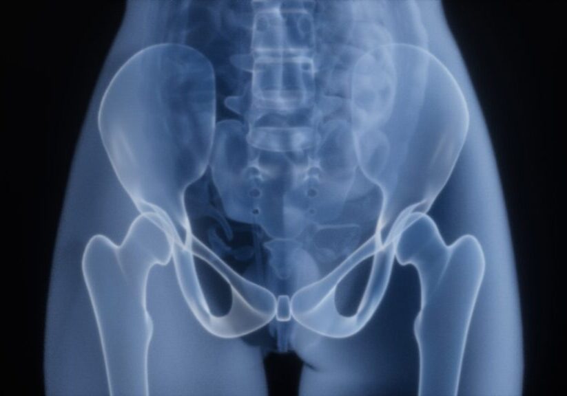 Feasterville hip fracture attorney