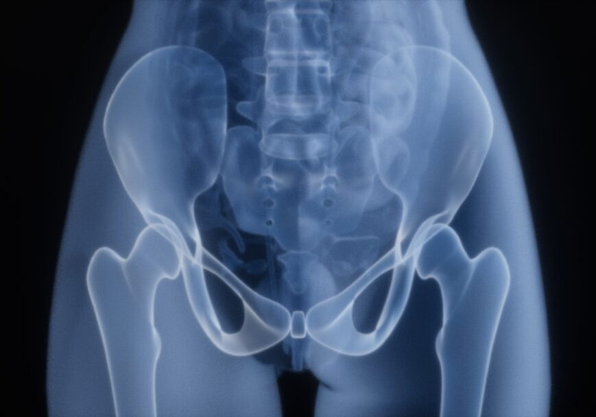 Feasterville hip fracture attorney