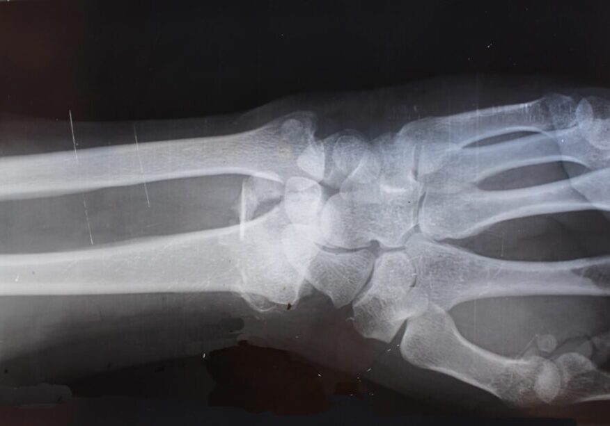 Pennsylvania work injury