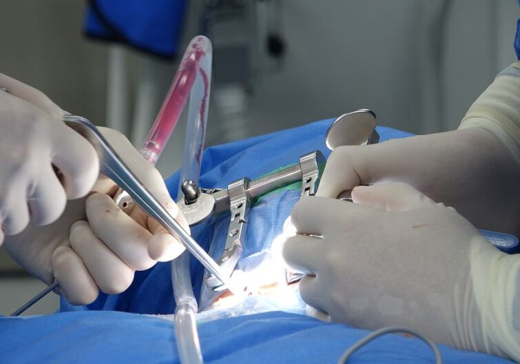 Spinal injury lawyer